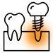implant